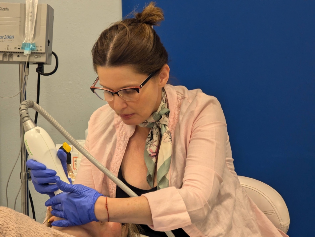 RF microneedling treatment at Mila Beauty Injections